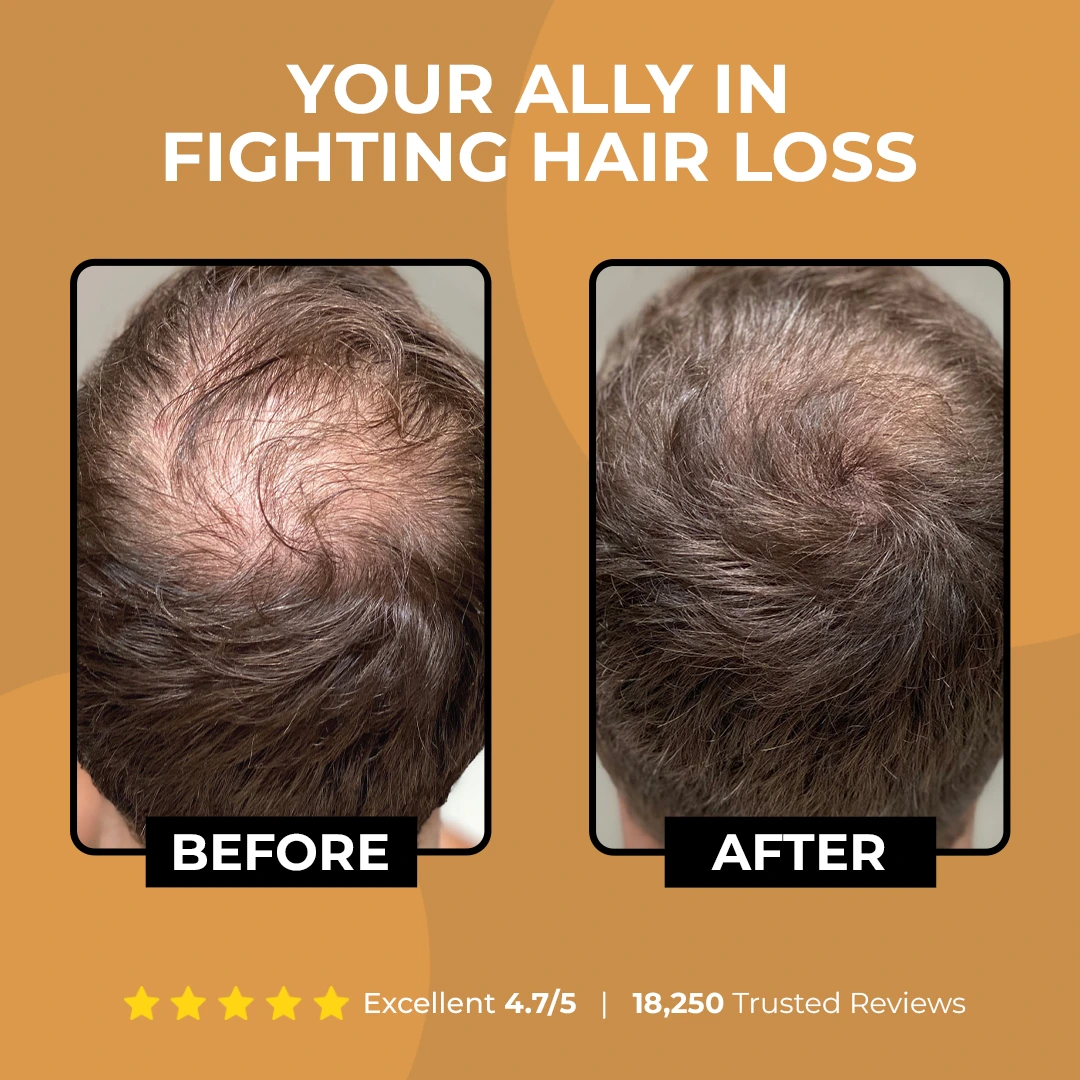 roshang Root Activator Shampoo