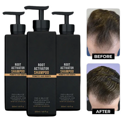 roshang Root Activator Shampoo