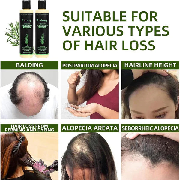 roshang Rosemary Shampoo