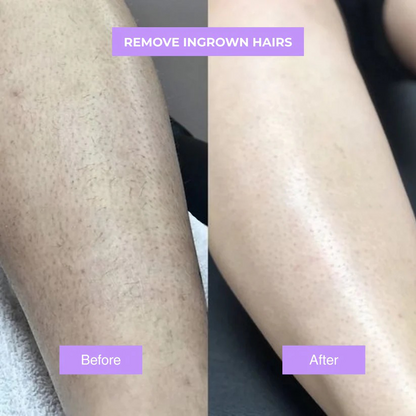 Roshang™ - Cyperus Rotundus Skin Serum