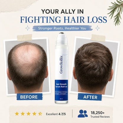 Advanced Hair Growth Roll-On Serum