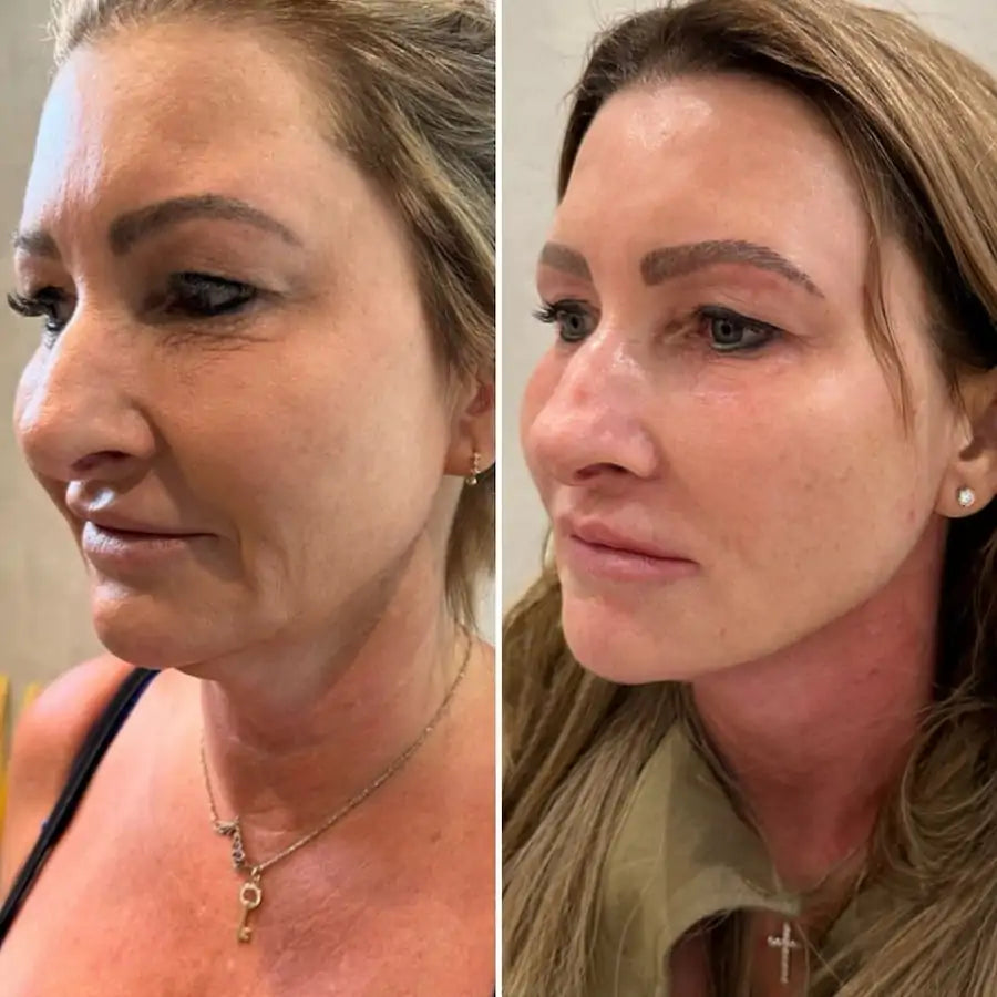 dd6a375dc706b01f5cc6d6f4497dd48f2a8e7a7243b59eecb5ae53a5744db553.webp