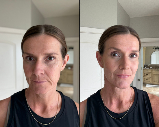 derma_before_after_2.png